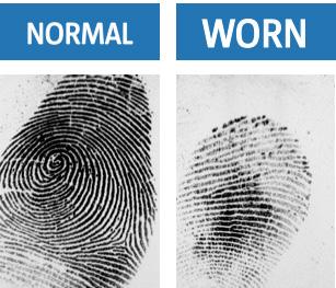 1.2. Biometrics 101 Fingerprints are not always perfect! There will be some people with scarred or worn fingerprints.