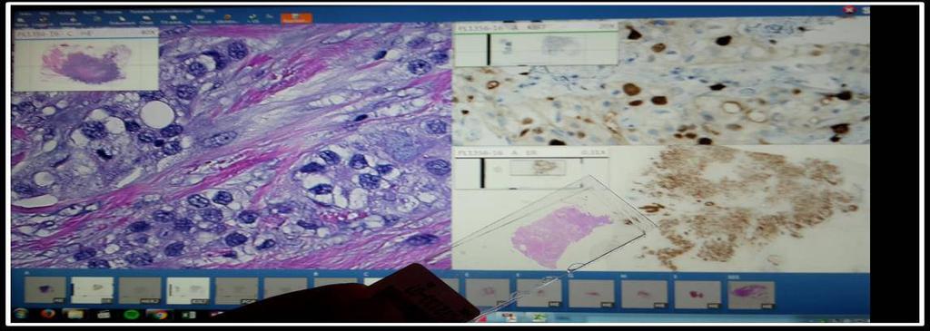 Digital pathology workflow and whole slide imaging Reduced transport and assorting Work-flow efficiency Ergonomic friendly Digitally supported documentation and traceability Computer aided diagnostic