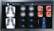 Multi-Modality Monitors With advances in medical imaging technology over the years, hospitals
