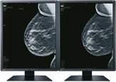 Breast Imaging Monitors It is vital in the process of early breast cancer detection that monitors display accurate and consistent quality