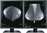 EIZO provides optimum diagnosis confidence with distinctive versions of the RadiForce Mammo-Series monitors for displaying breast screening 