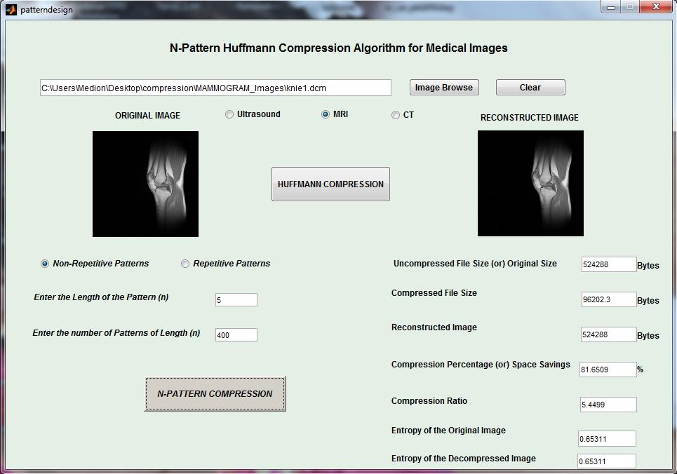 were appealing, the proposed method has been applied on the other common types of medical imaging data like CT and Ultrasound images. Fig. 5. N-Pattern technique for sample 1.
