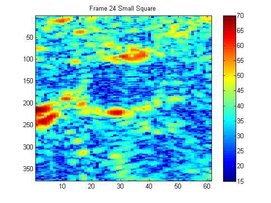 Magnified image of areas of interest in frame 24 and 25 We then wrote a script called ForearmFor.m i that used two for loops to implement our cross correlation function on the two squares.