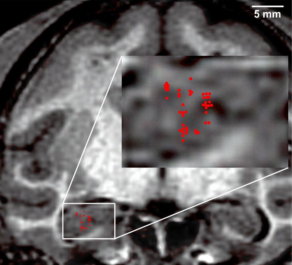 Supplementary Figure 1. Approximate recording sites for visually-responsive units in both monkeys, superimposed on a coronal MRI image from one of the monkeys.