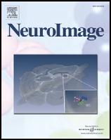 NeuroImage 44 (2009) 520 530 Contents lists available at ScienceDirect NeuroImage journal homepage: www.elsevier.