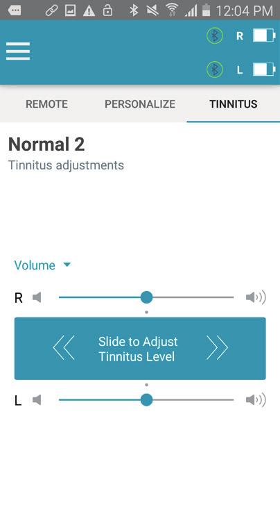 TINNITUS The professional may enable the tinnitus stimulus in any memory of the hearing devices.