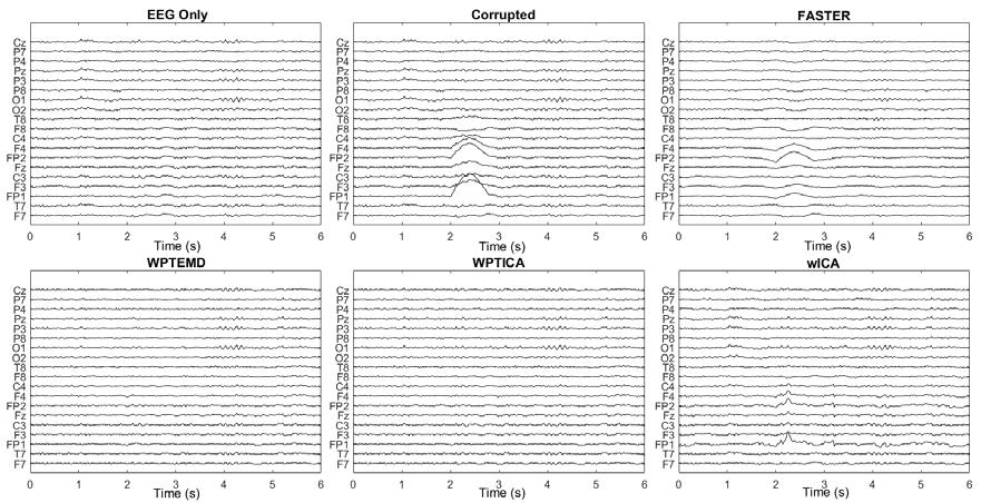 WPTEMD and WPTICA algorithms performances for eight types of real artifacts, resembling a natural movement while the EEG is being acquired. 2.7.
