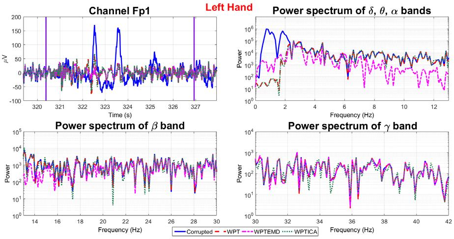 An example of the left hand-movement is shown in Figure 15: the high amplitude oscillations in the time interval 322-324 s are significantly reduced and the best performance is given by the WPTEMD.