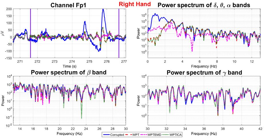 Figure 16: EEG data in time and frequency domain contaminated by the right hand movement in channel Fp1.