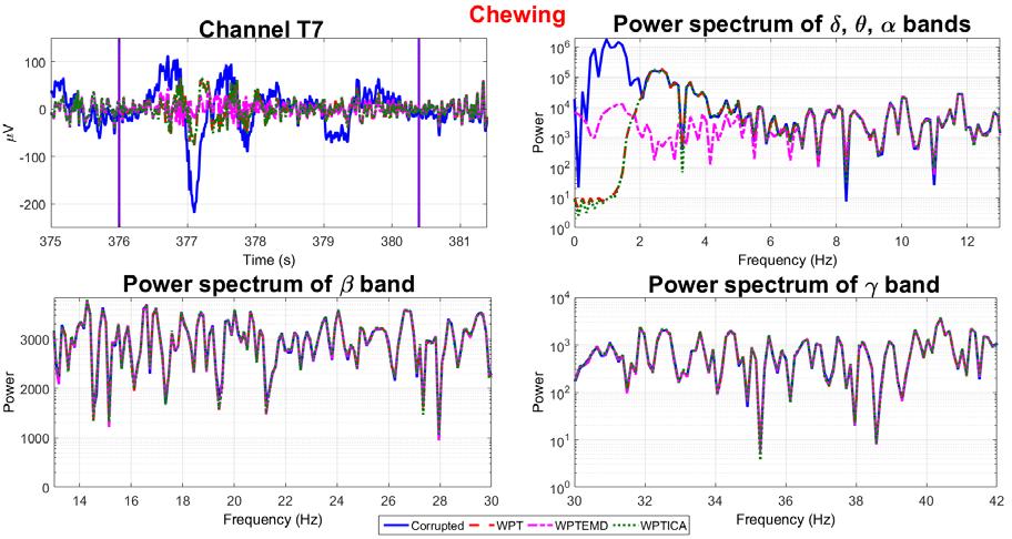 The frontal and temporal electrodes are affected by the artifacts caused by the muscles activity during chewing. The high amplitude oscillations are better reduced by the WPTEMD as shown in Figure 17.