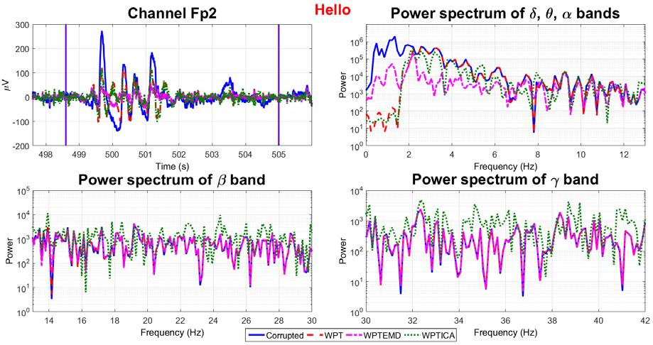 Figure 18: EEG data in time and frequency domain contaminated by talking in channel T7.