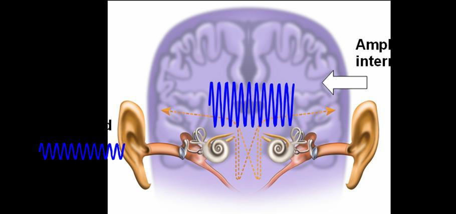 Decreased Sound Tolerance (DST) and Hyperacusis: What is DST and Hyperacusis? Decreased Sound Tolerance (DST) is discomfort from sounds at a level which most people would not find uncomfortable.