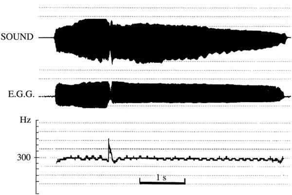 Bernard Roubeau, et al Laryngeal Vibratory Mechanisms 429 FIGURE 6. Sustained sound with change of laryngeal mechanism.