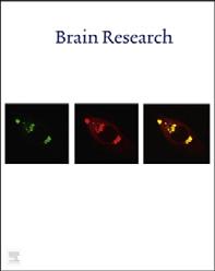 brain research 1506 (2013) 94 104 Available online at www.sciencedirect.com www.elsevier.