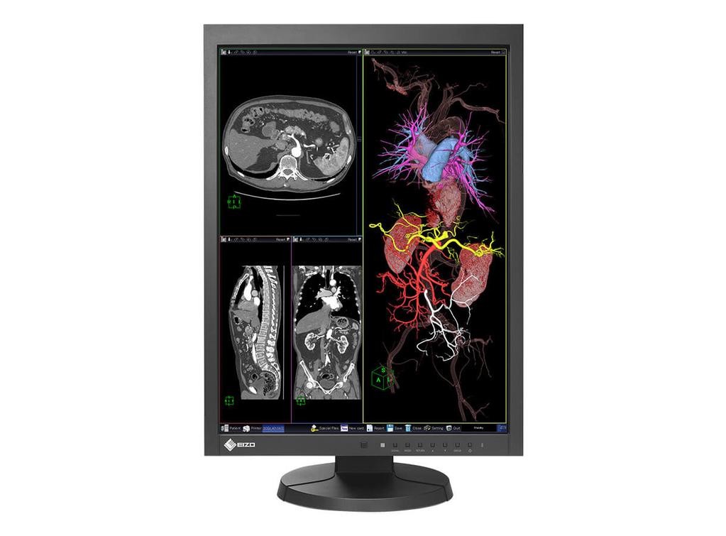 MX215 Your advantages The EIZO MX215 features factory-preset DICOM tonal values and displays greyscale tones of radiological images in accordance with the requirements of the object.