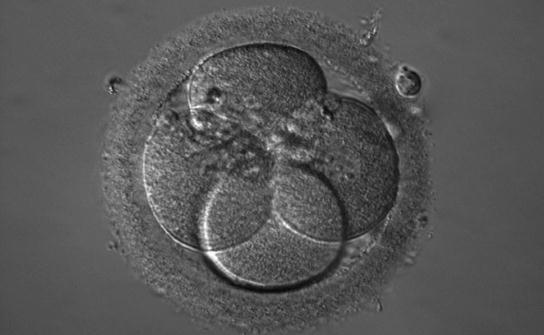 Your Insight Into the Technology Behind it The IVF contrast system unites ihmc, PlasDIC and DIC without mod ification The new IVF contrast system is particularly effective in IVF labs: switch at will
