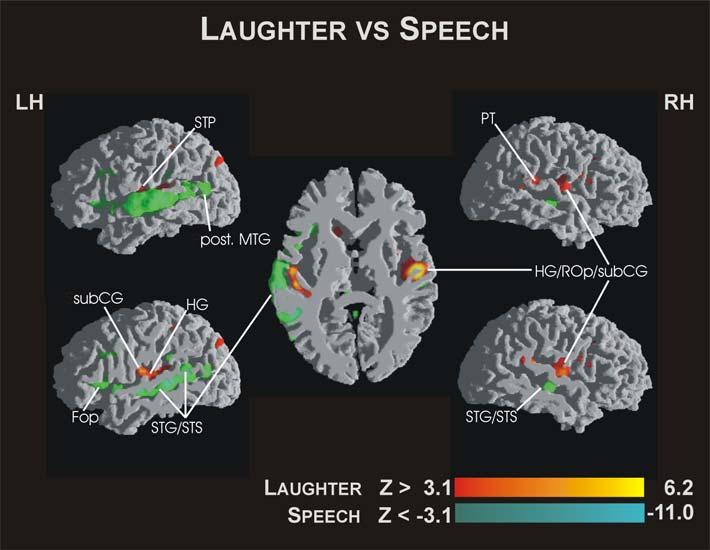 fmri study Nonvocal sounds => initial steps of auditory analysis Laughter Rhythm (Isochrony) Vocal timbre but no