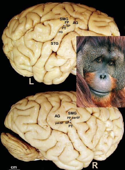 Comparable anatomy of perisylvian cortex