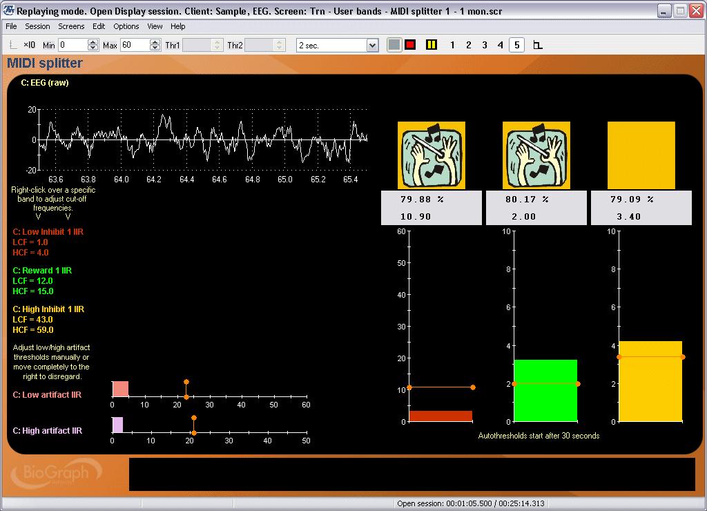 Training MIDI Splitter 1 (2 screens) Another variation on the three bar graph screen, this one uses a MIDI splitter instrument to play individual voices of a MIDI song when each band is
