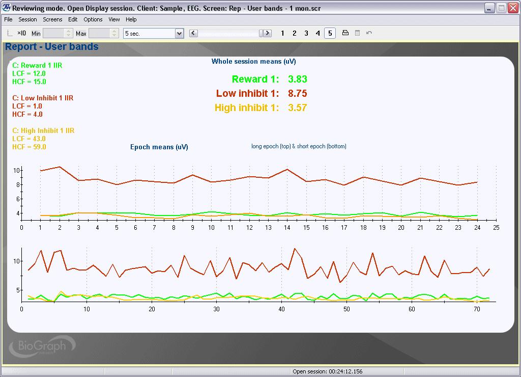 Report 3 User Bands 1 This report screen shows trend graphs of the mean amplitude for the trained bands (user specified short and long epoch durations).