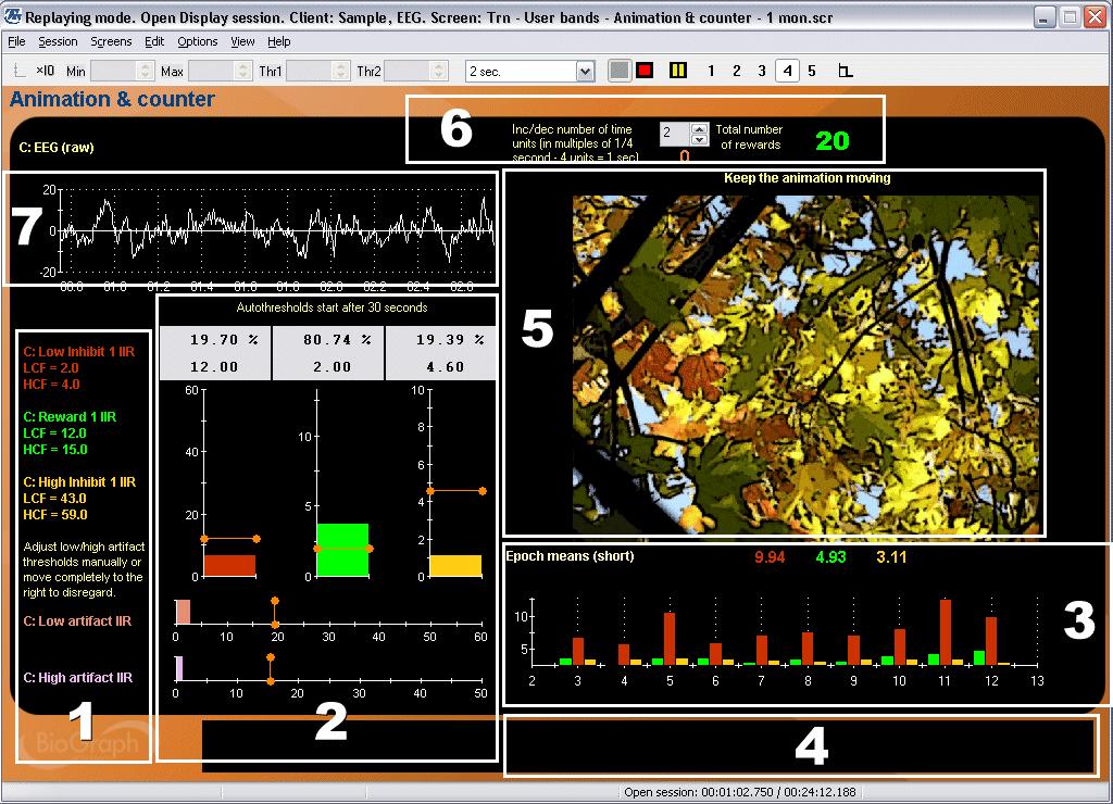 General Anatomy of a Feedback Screen Most of the screens included in the EEG Suite follow the same screen arrangement structure to facilitate their usage.