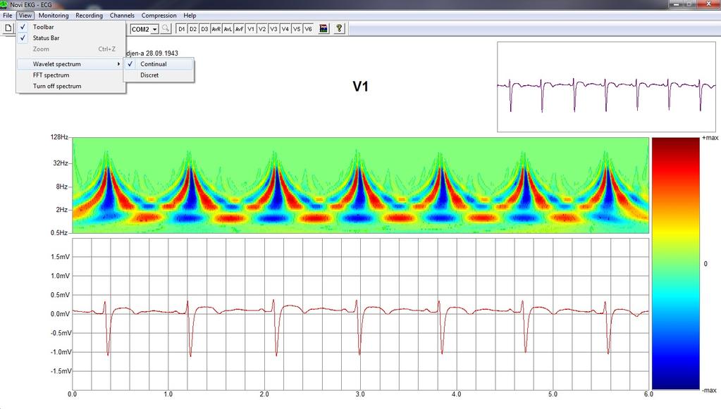 Multithreaded Application for Real-Time Visualization of ECG Signal Waveforms and their Spectrums 551 Figure 1: The Screenshot of PC-ECG Application waveform, calculation of coefficients and drawing