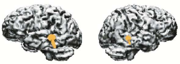 210 Cognitive neuroscience Figure 2 (a) (b) Language x = ±43.35, y = 34.25,z = 3.3 q (left/right) = 40.8/30.5 nam Music x = ± 44.75, y = 36.95, z = 2.65 q (left/right) = 57.3/49.