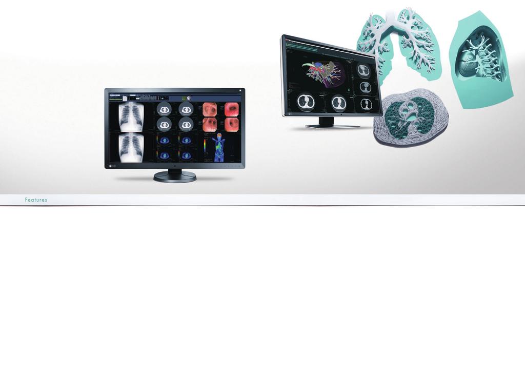 RadiForce MultiSeries MultiModalit y Monitors With advances in medical imaging technology over the