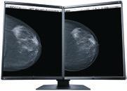 As the world's first medical monitor with an LTPS (low temperature polysilicon) panel, the RX560 can achieve a maximum brightness of 1100 cd/m2 and a
