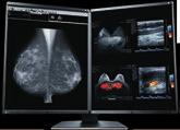 RadiForce MammoSeries Breast Imaging Monitors It is vital in the process of early breast cancer detection that monitors display accurate and consistent