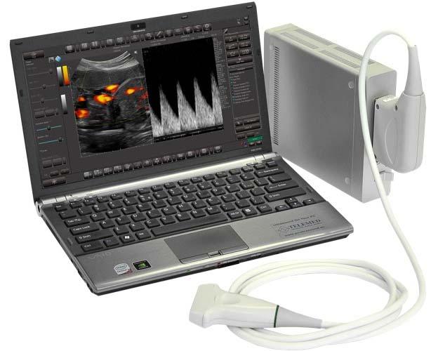 ClarUs EXT TELEMED ULTRASOUND DIAGNOSTIC SYSTEM INFO ClarUs is a high performance Echo Color Doppler beamformer with a PC based software driven architecture: a versatile platform with great potential