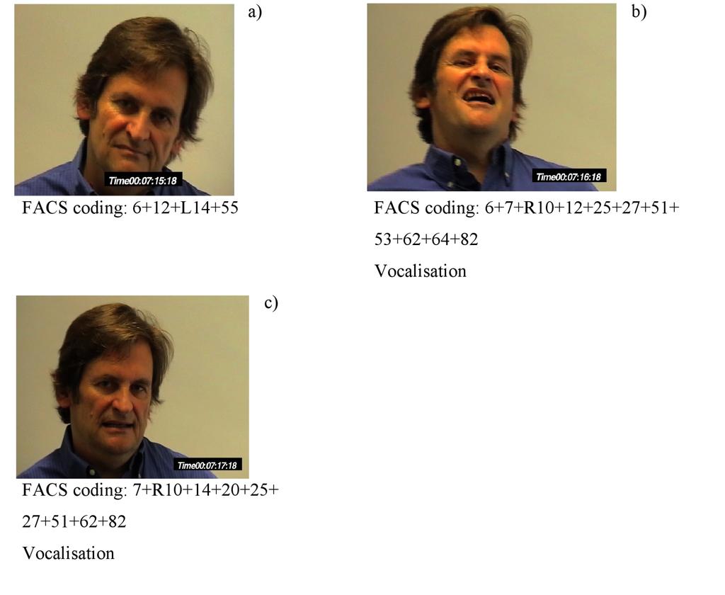 SULKY AND ANGRY LAUGHTER 11 Figure 2. Typical phases of angry laughter and corresponding FACS coding. 1a = beginning; 1b and c = middle part; 1d = ending.