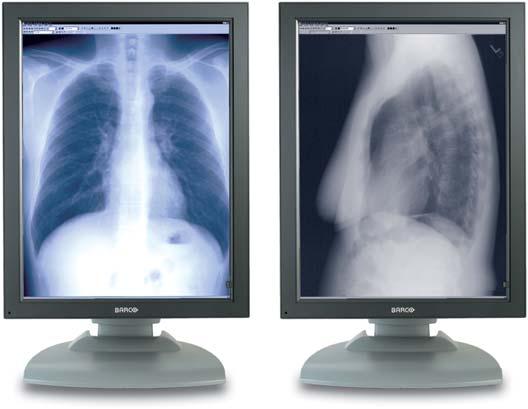 allowing radiologists to work in their preferred color temperature.