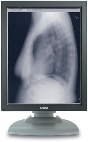 Barco medical imaging systems Many years of experience in all areas of display technology gives Barco a unique advantage as it continues to expand its color and grayscale display technology for a