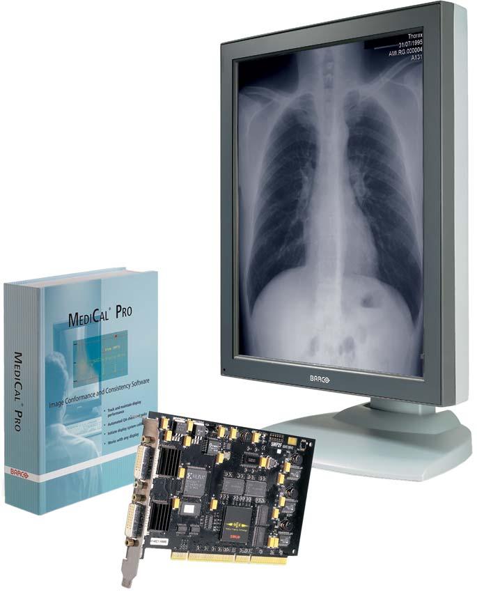 Filmless perfection in 1, 2, 3 and 5 MegaPixel Building upon its vast expertise in providing high-resolution display solutions for medical imaging, Barco has developed its CORONIS family of digital