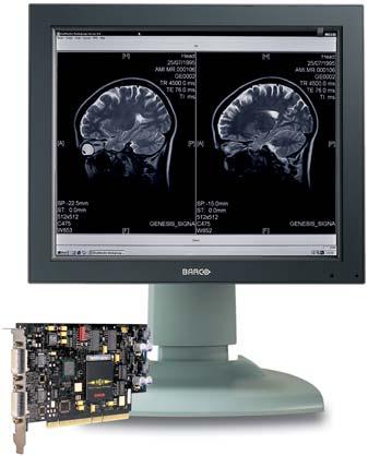 CORONIS 1MP complies with the DICOM/CIE viewing standards: it features