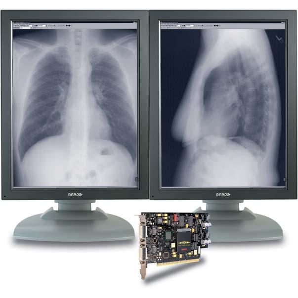 standards for medical imaging. CORONIS 3MP features a 20.8" grayscale flat panel with a resolution of 1536 x 2048 and a protective glass cover for perfect image representation.