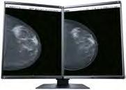 When viewing such large data on a monitor with less than 5 megapixel resolution, there may be