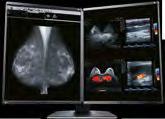 EIZO provides optimum diagnosis confidence with distinctive versions of the RadiForce