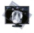 1") Color LCD Monitor Stay Cost Efficient For environments using clinical record applications for image referencing, more