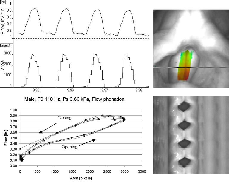 Granqvist S et al.: Simultaneous analysis of vocal fold vibration... Figure 6.