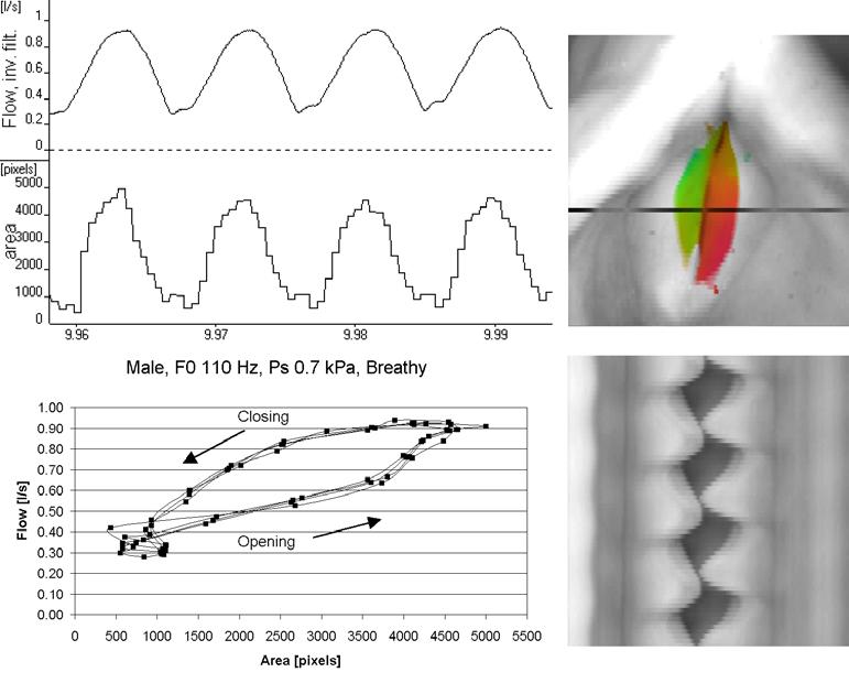 TMH-QPSR, KTH, Vol. 45, 2003 Figure 5. Example of four cycles recordings of breathy phonation as produced by the male subject.