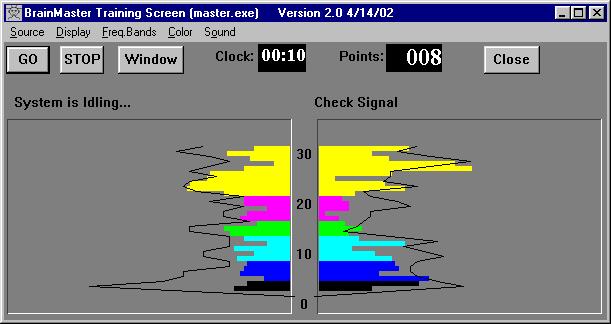 3.8 BrainMirror (FFT) Pane This is similar to the display on the BrainTracer, WaveRider, and HAL devices.