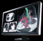 This ensures medical professionals are viewing the most consistent shading possible on their screen for the most