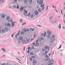 Cytoplasmic tissue Epithelial 