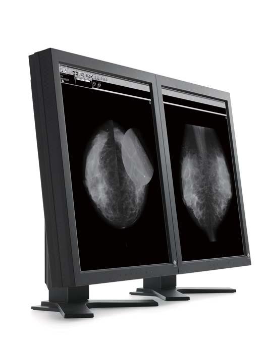 5MP MONOCHROME Featuring high-resolution and high-definition, the RadiForce GS520 is designed specifically for displaying digital mammography, DR and CR images and comes with a choice of glare panels