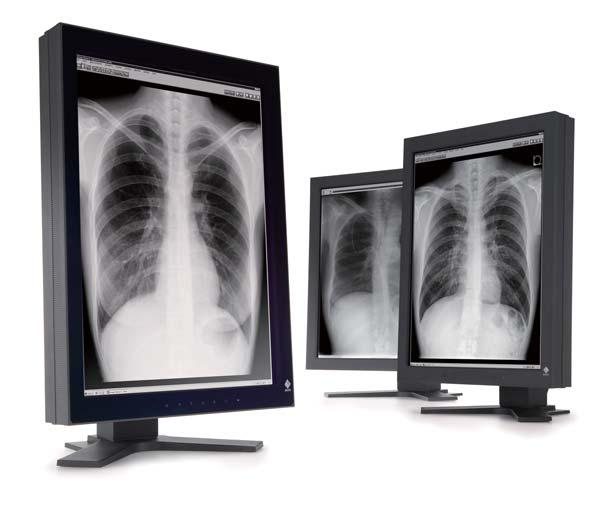 MP MONOCHROME With MP monochrome monitors the entire chest CR can be displayed, offering highly refined rendering of extremely delicate grayscale shadings.