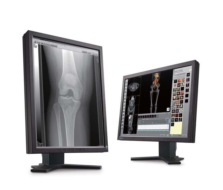 2MP 2MP MONOCHROME COLOR The 2MP monitors are ideal for a wide variety of tasks from viewing of ultrasound, endoscope, CT and MRI images to use as a PACS/HIS/RIS terminal.