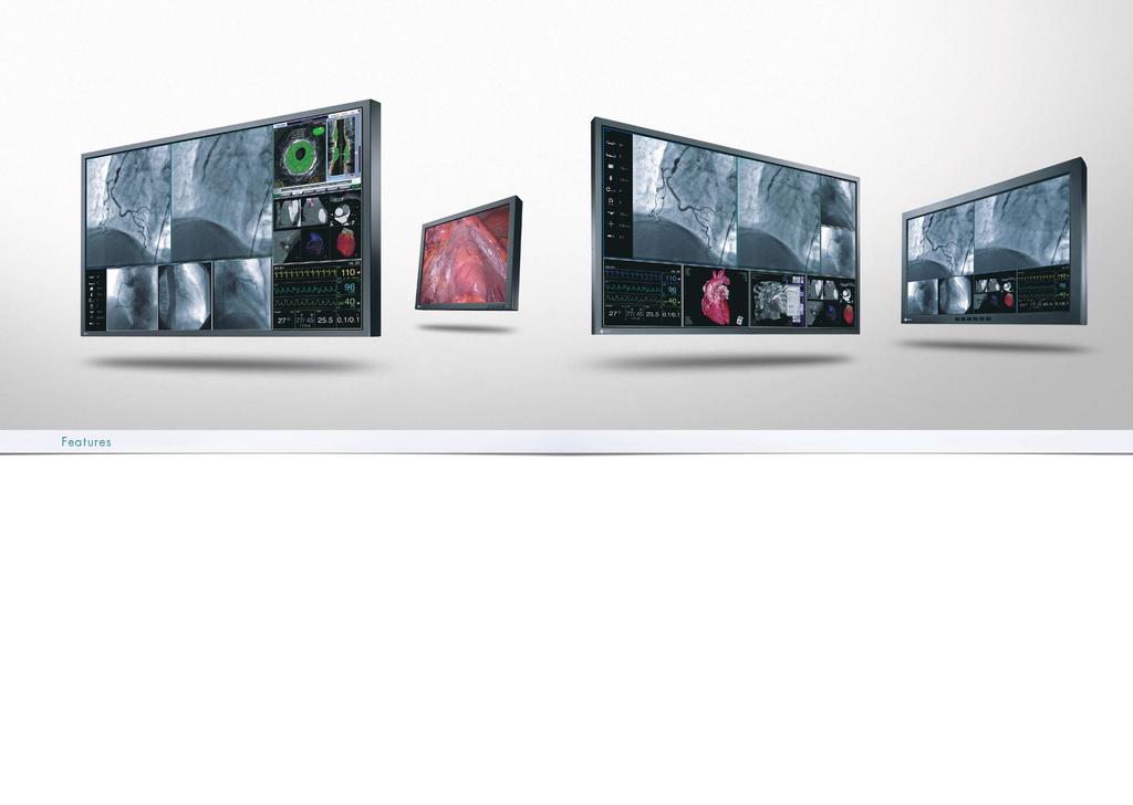 Monitors for Interventional Rooms With a selection ranging from space-saving compact screen monitors up to a 60-inch large screen for flexible image layouts, EIZO offers a complete spectrum of