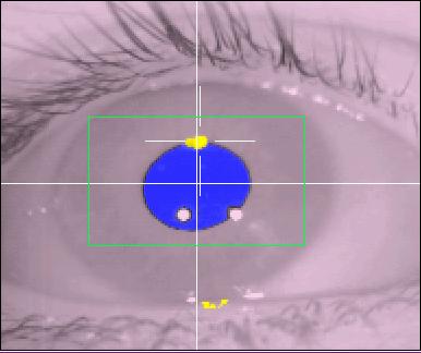 Image Pupil too Low in Image Figure 3-2: Size and Vertical Eye